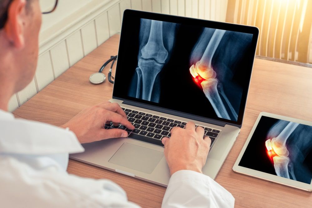 Doctor watching a laptop with x-ray