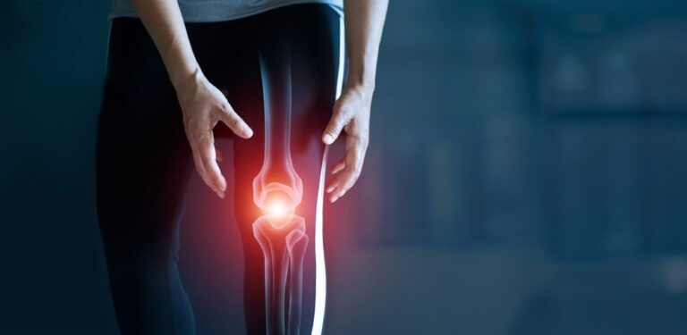 Woman suffering from pain in knee