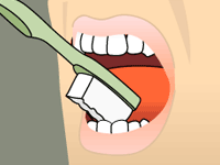 Brushing: Step 4 Illustration