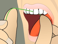 Flossing: Step 3 Illustration