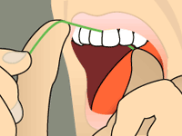 Flossing: Step 4 Illustration