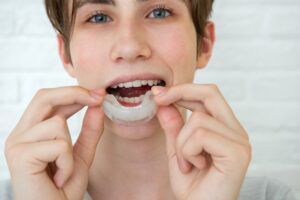 Positive teen boy holds mouth guards for her teeth.