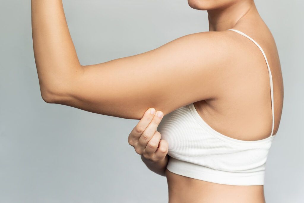 woman grabbing skin on her upper arm with excess fat