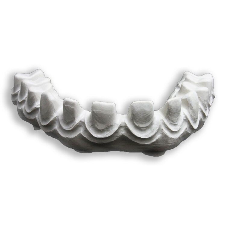 Bleaching orthodontics tray for teeth