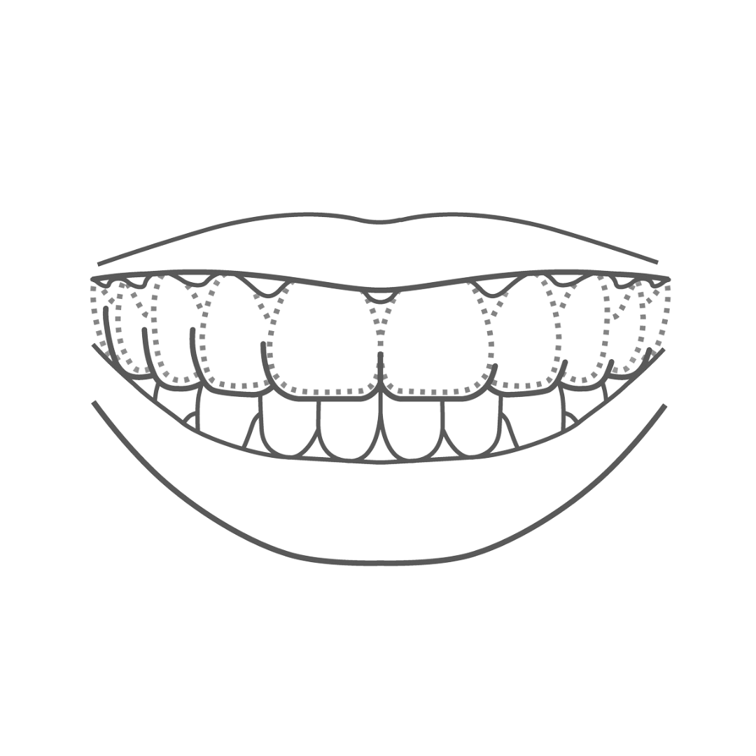 Aligners icon