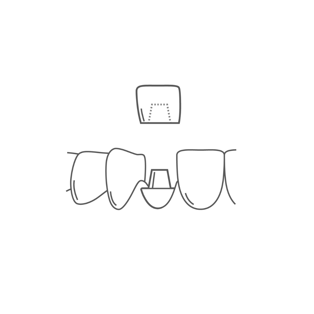 Metal tooth implant icon