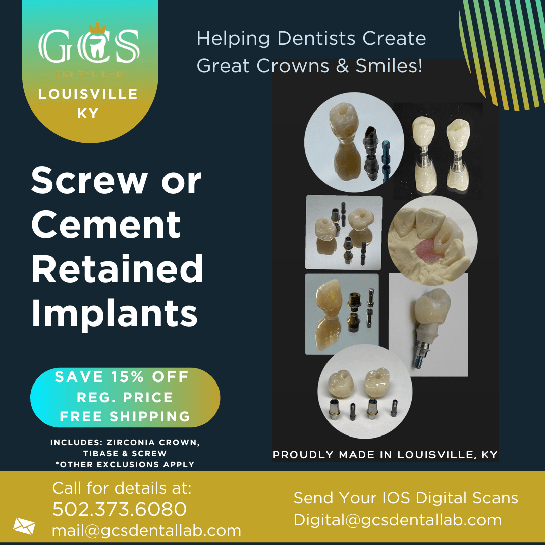 Screw Retained Implants promotion banner