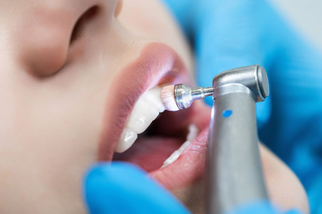 Teeth with brushing technology in the dentist's office