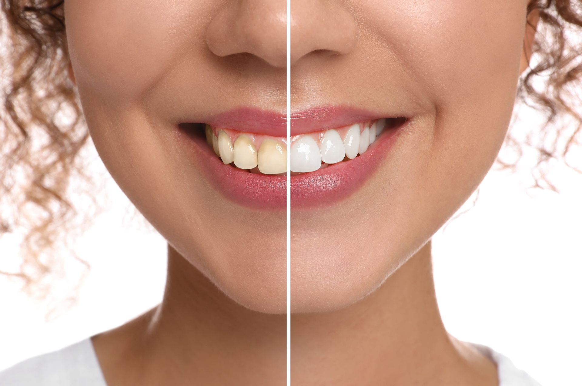 woman divided in halves before and after tooth whitening