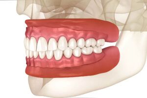 Artificial gum and teeth 3D illustration