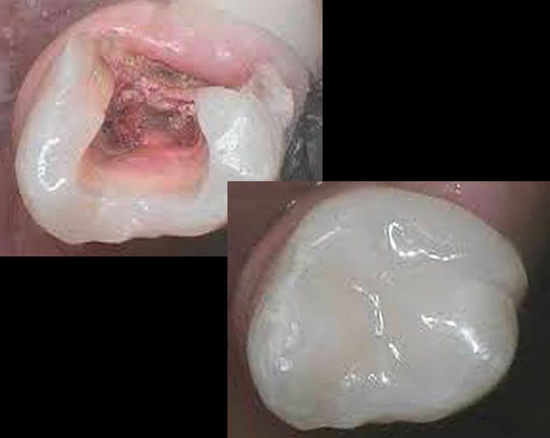 Biomimetic Dentistry