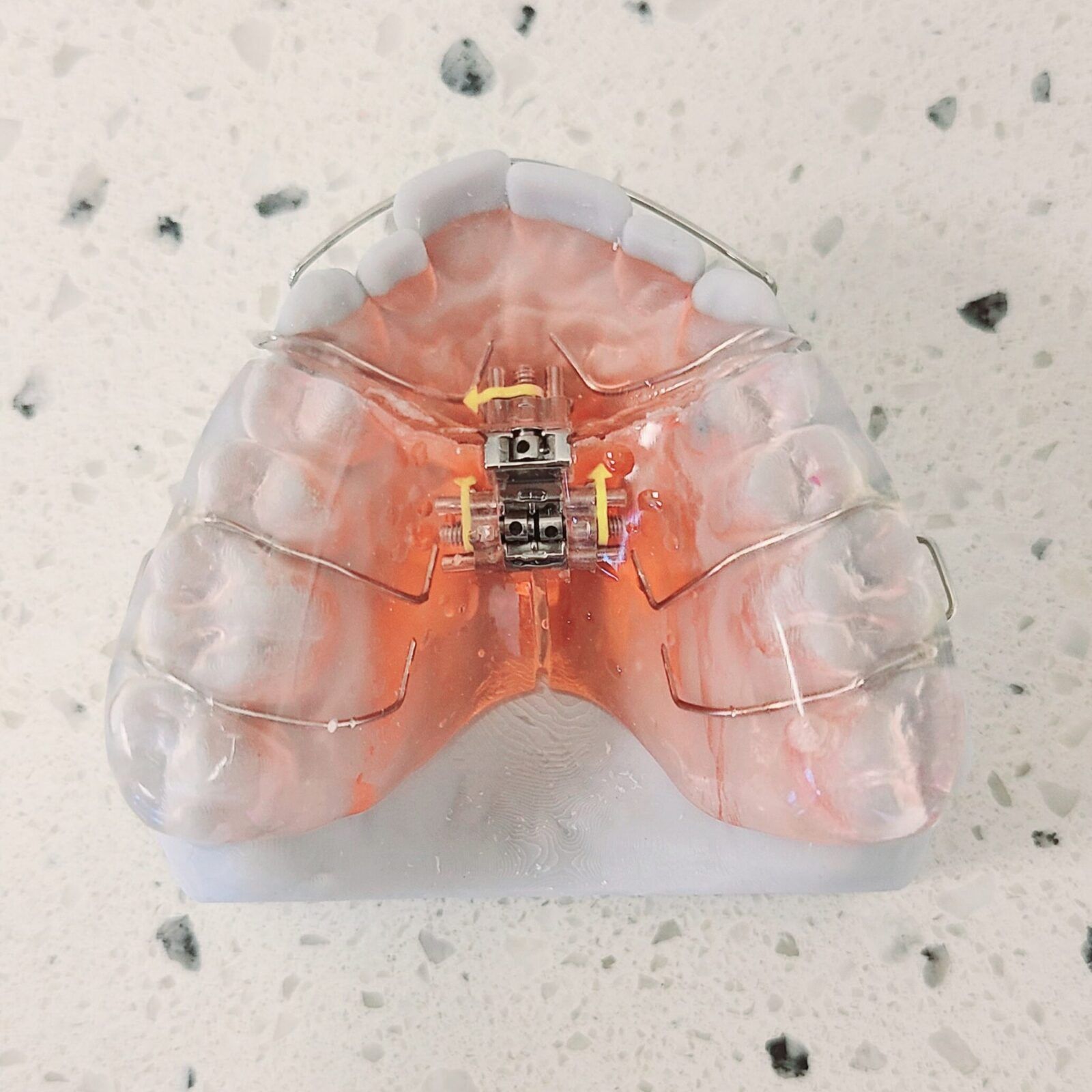 Dental model used in dentistry