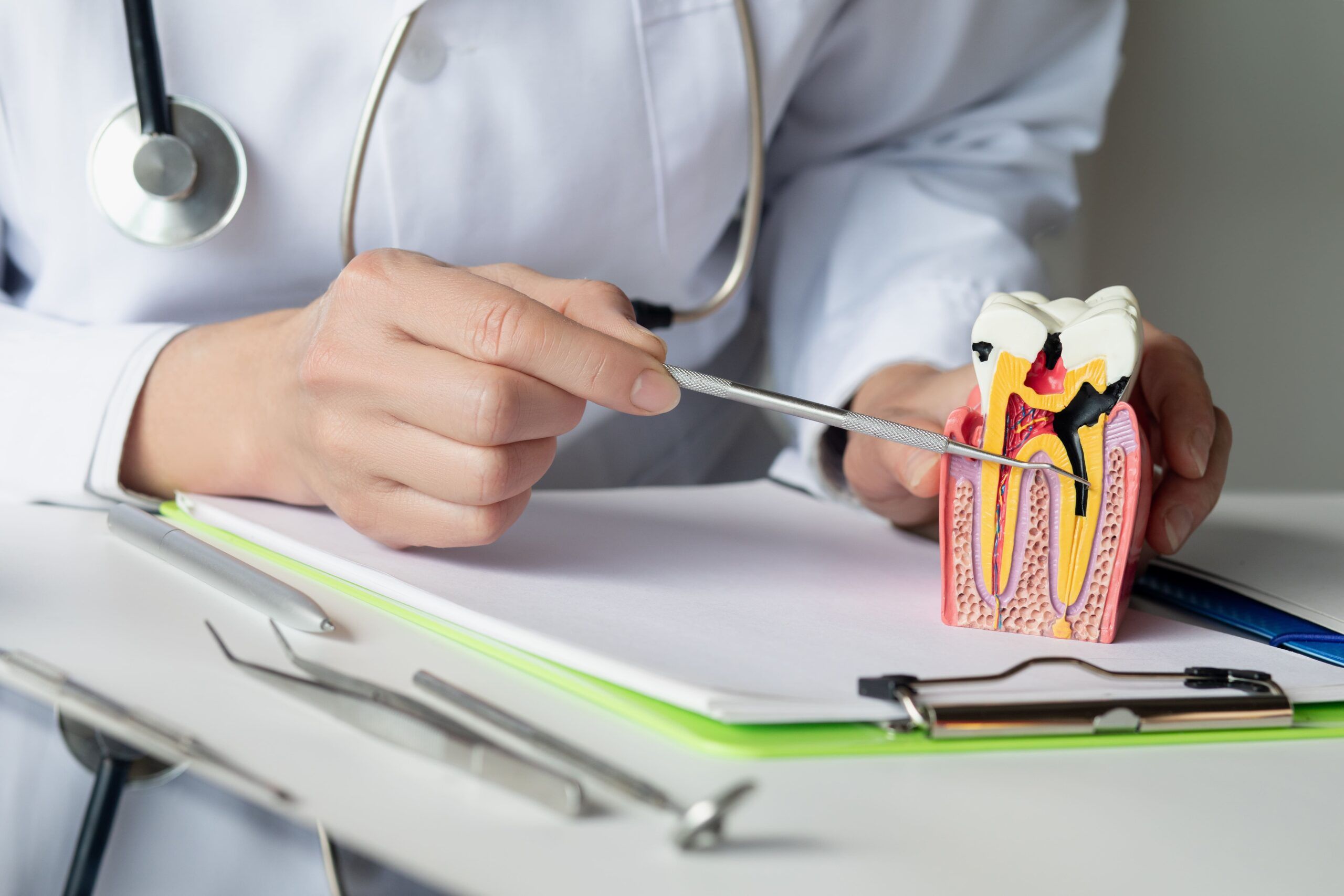 The dentist shows the disease and the formation of the tooth pulp.