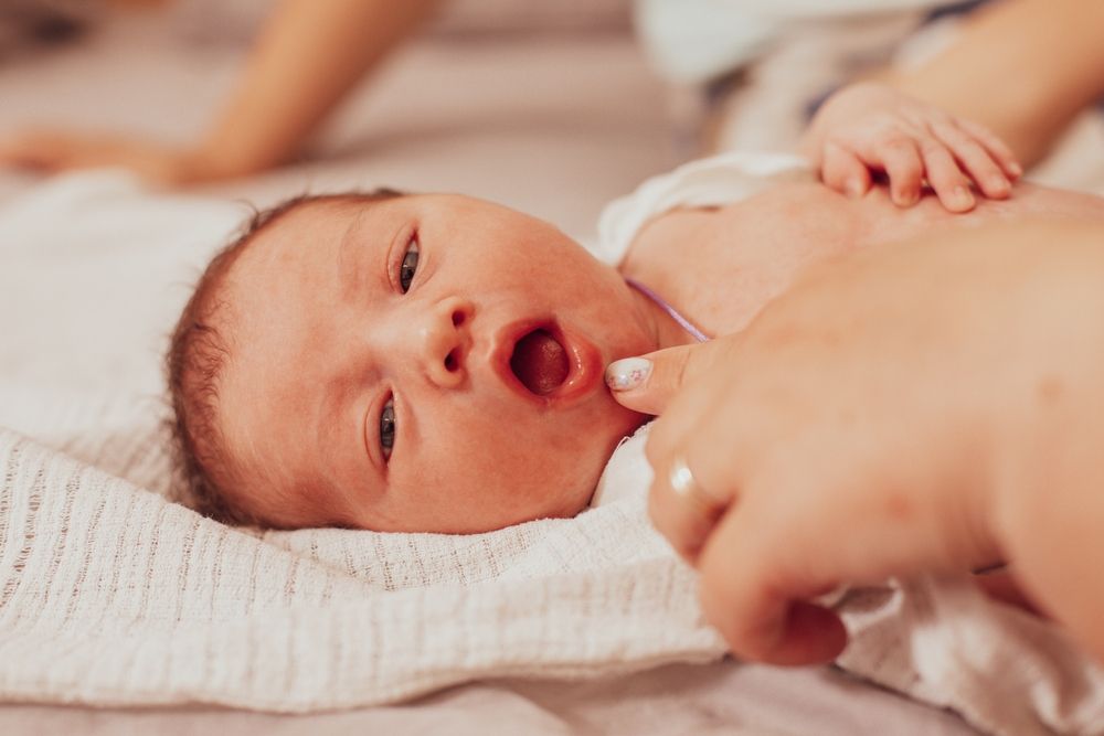 How To Identify Tongue & Lip Ties in Newborns