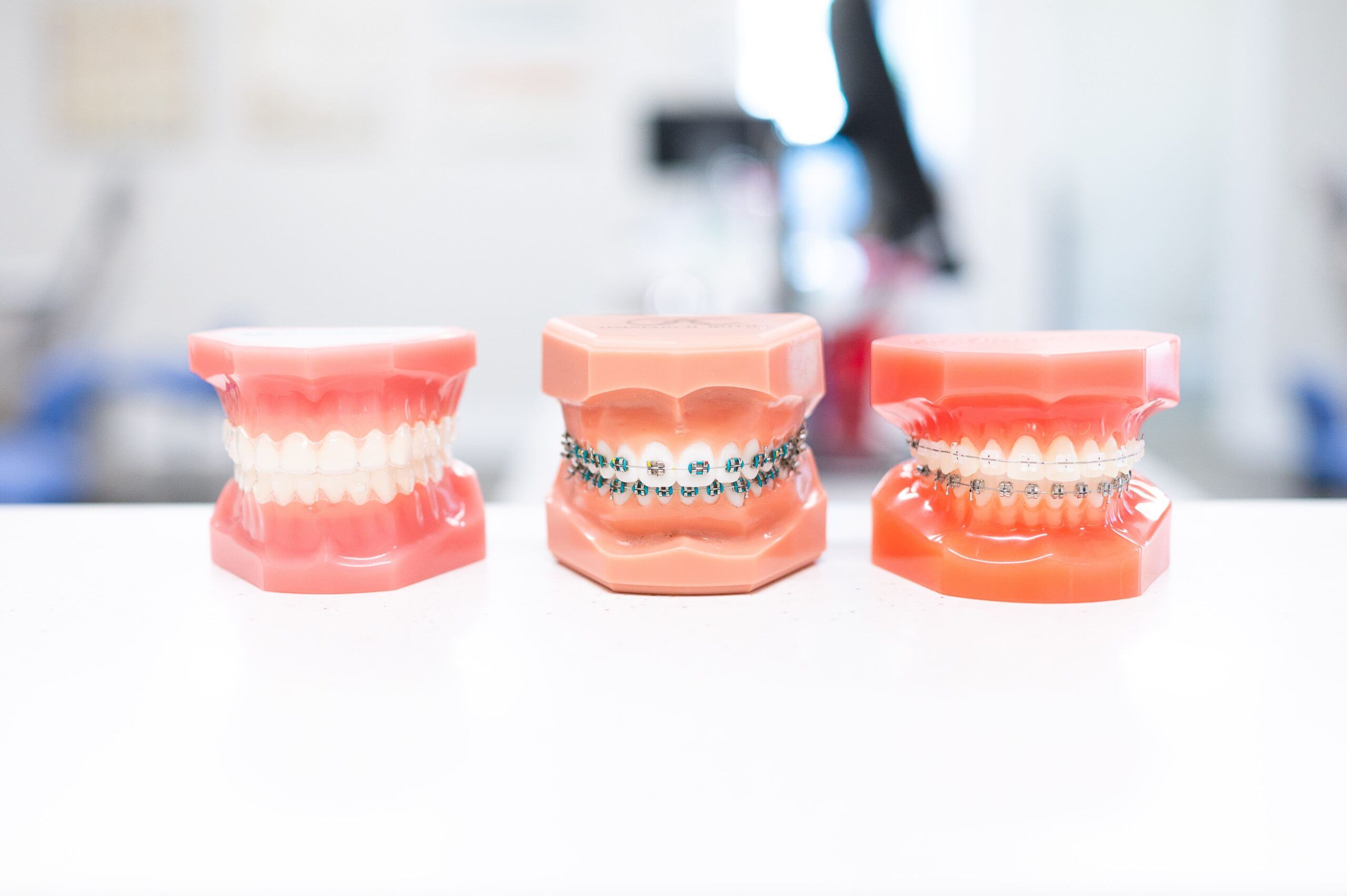 Dental model of the human jaws with teeth and braces