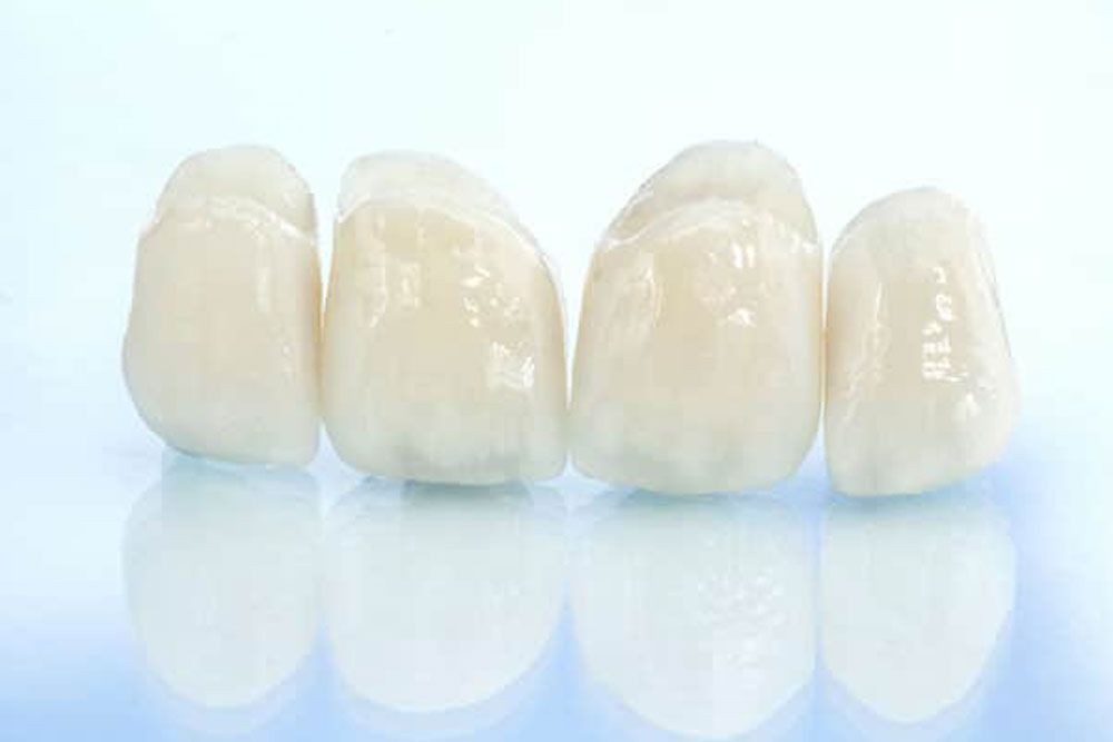 Metal free ceramic dental crowns