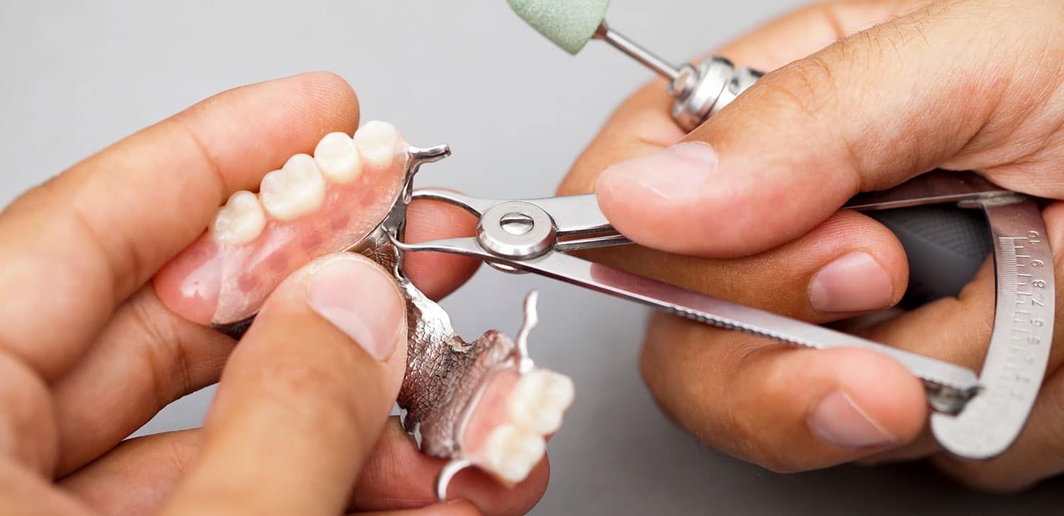 Dentists examine dental models in the clinic for treatment