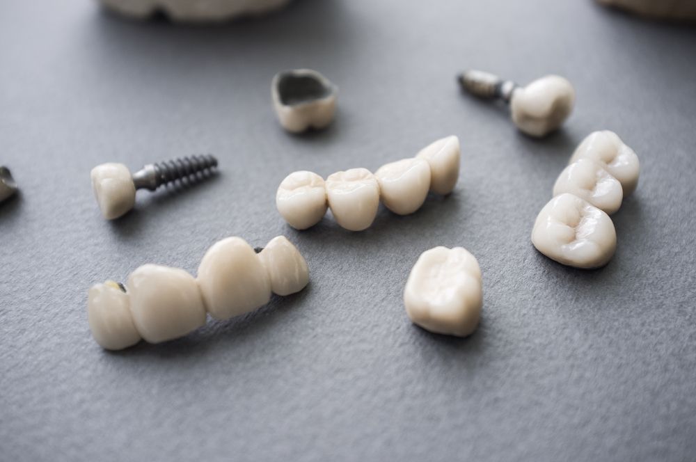 Ceramic dentures and crowns on gray background.