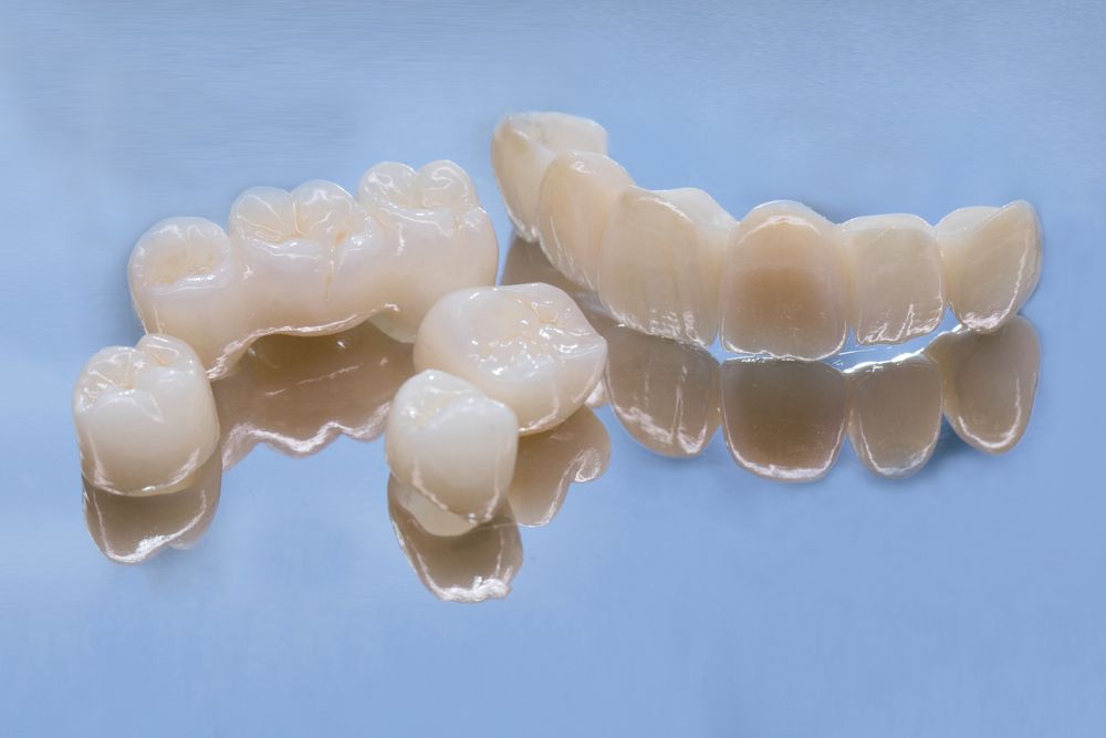 Metal Free Ceramic Dental Crowns. Ceramic zirconium in final version