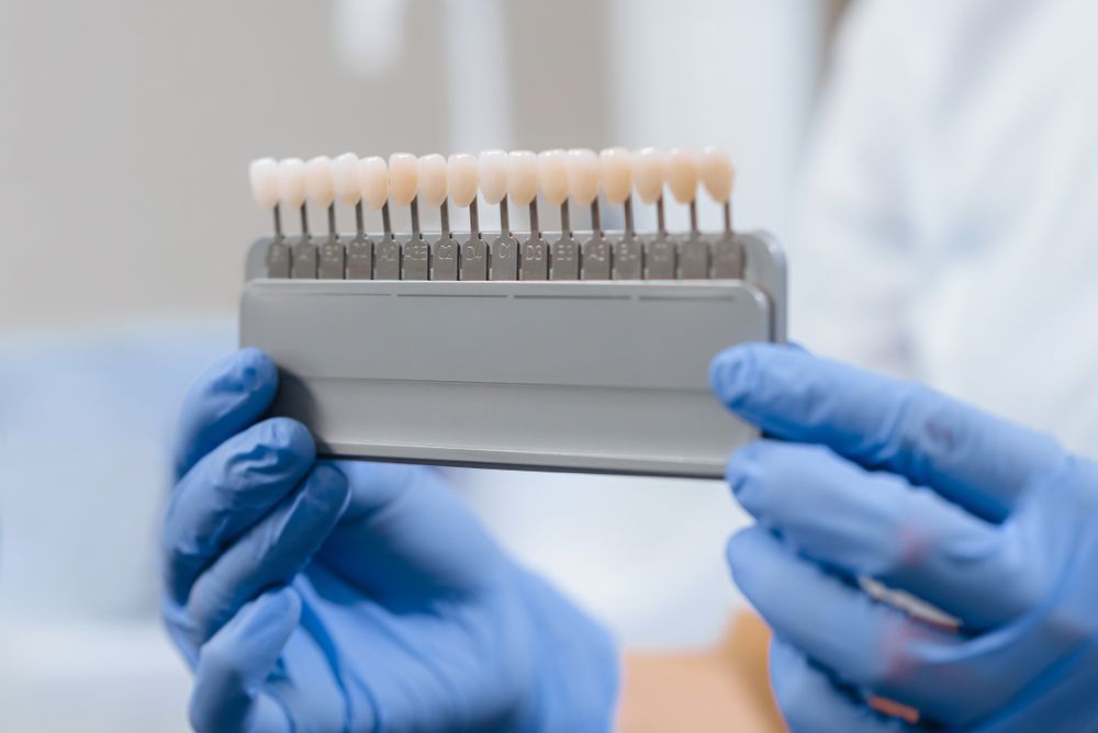 Dentistry. Teeth whitening. A device for assessing the color of tooth enamel in the hands of a dentist. Close-up.