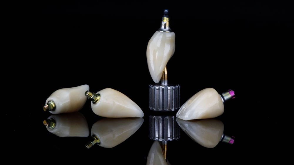 set of dental crowns for anterior incisors after implantation