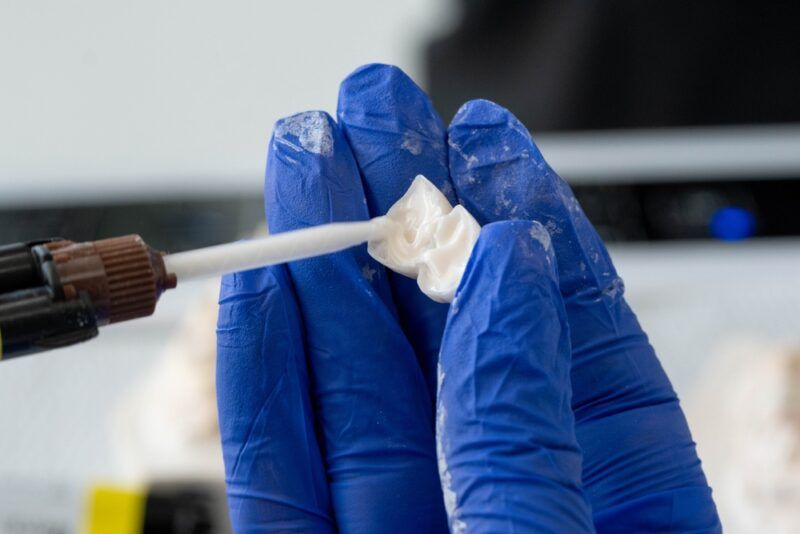 applying glue before putting dental crowns