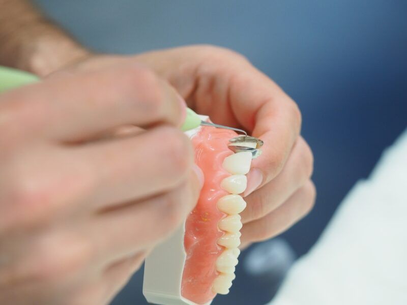 training for anterior composite restorations