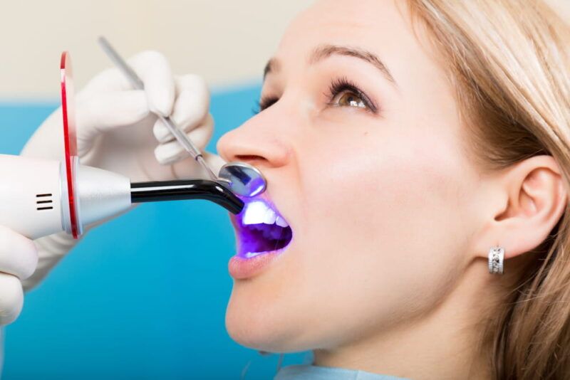 Dentist working with dental polymerization lamp in oral cavity
