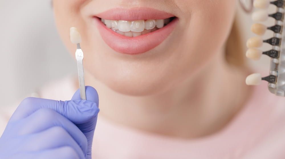 Caucasian female adult smiling at dental veneer sample for perfect tooth match, stomatology concept.