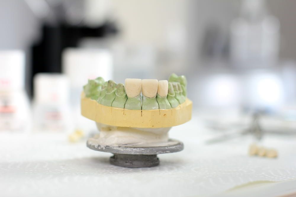 Ceramic crown on gypsum model in dental laboratory