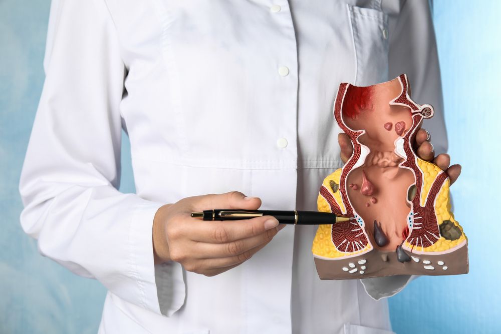 Doctor Pointing At Model Of Unhealthy Lower Rectum