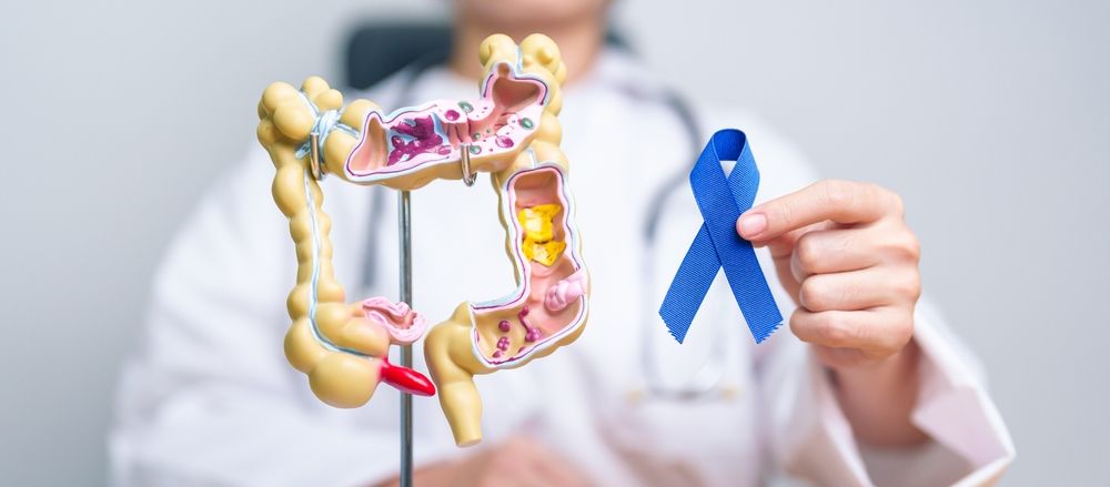 Doctor Holding Blue Ribbon With Human Colon Anatomy