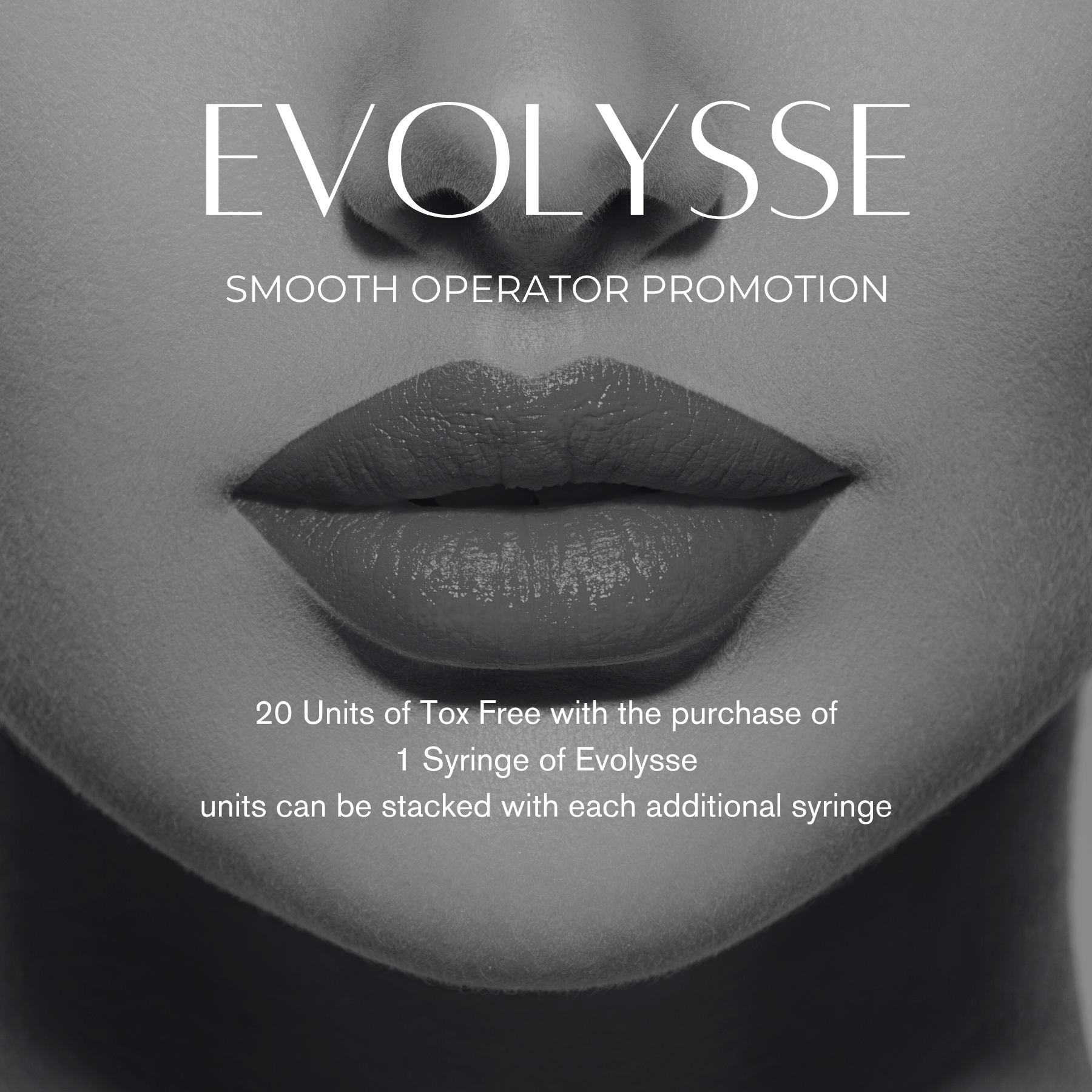Evolysse SMOOTH OPERATOR PROMOTION 20 Units of Tox Free with the purchase of 1 Syringe of Evolysse units can be stacked with each additional syringe
