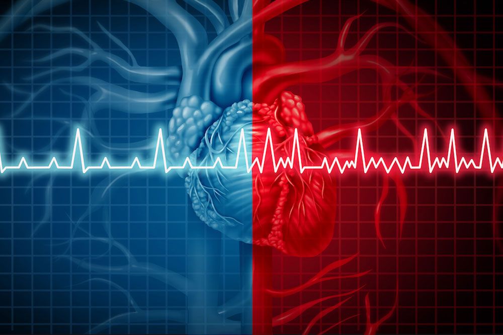 Atrial fibrillation and normal