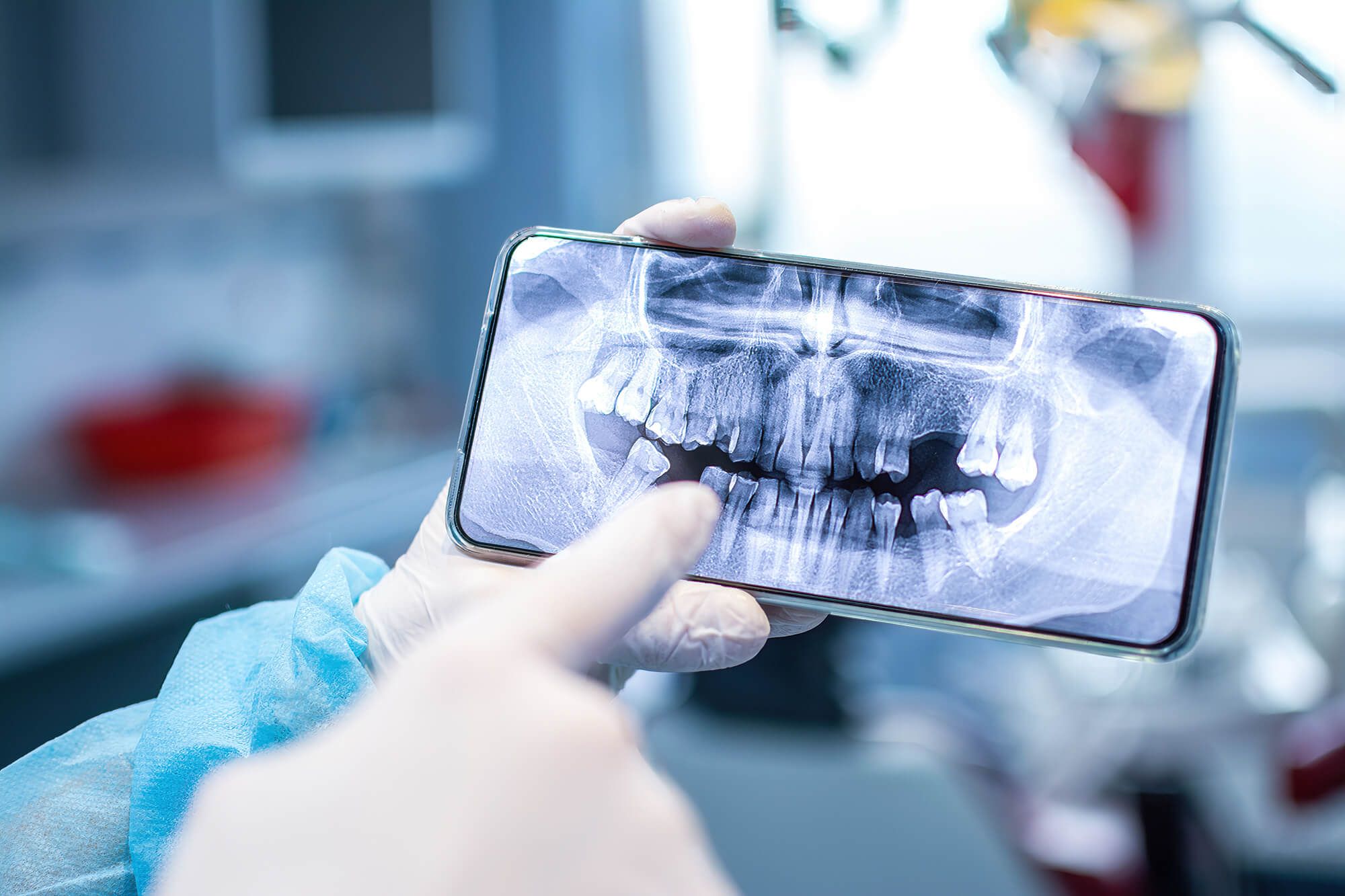 Phone showing x-ray of teeth