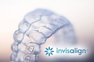 Invisalign