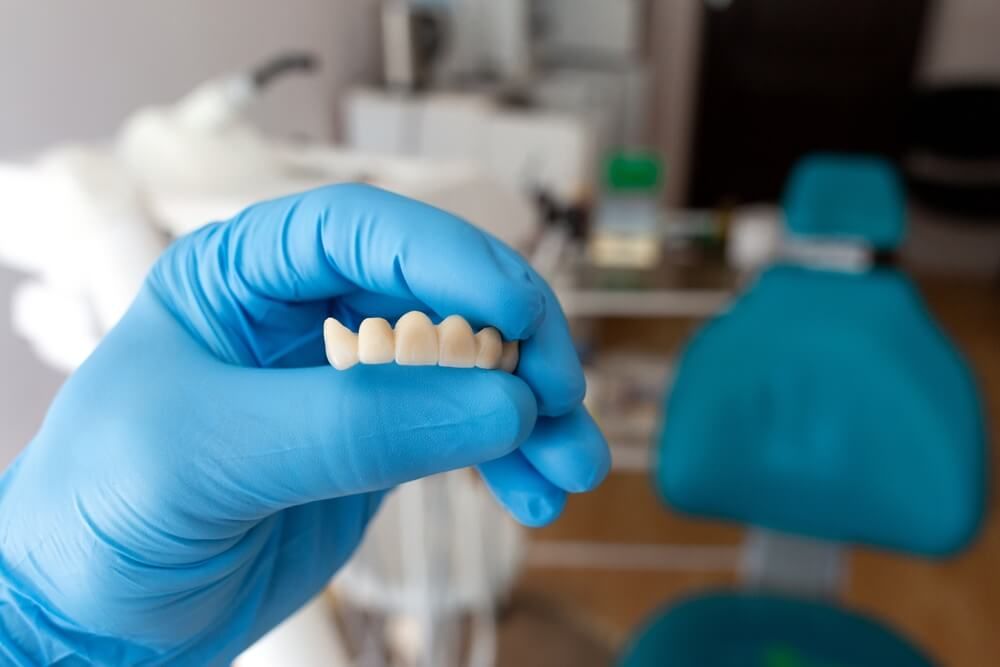 non-removable dental prosthesis in doctor's hand