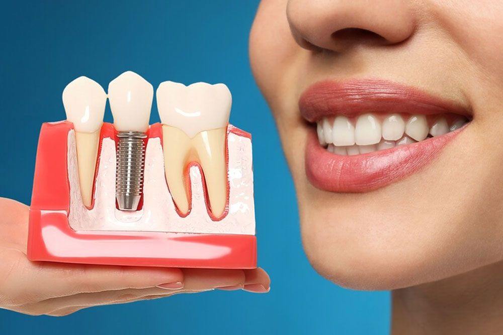 Young woman with beautiful smile and dentist holding educational model of dental implant