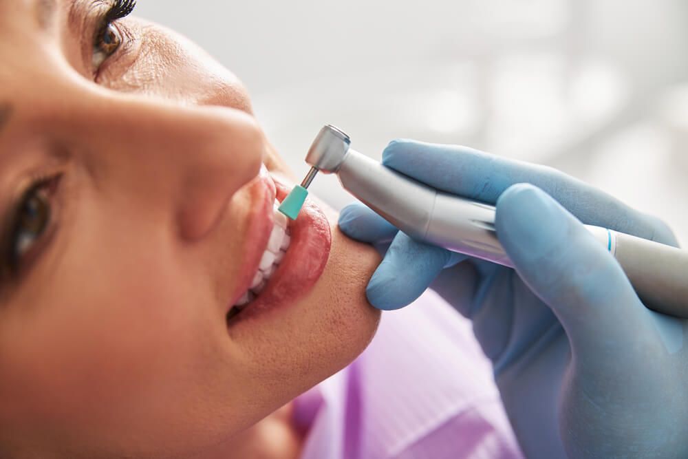 Dental instrument held by fingers on a dentist with prophy cup on its tip cleaning teeth of patient