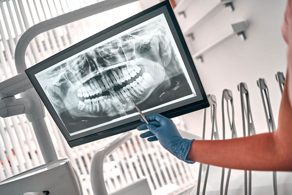 dentist presenting with tooth x-ray