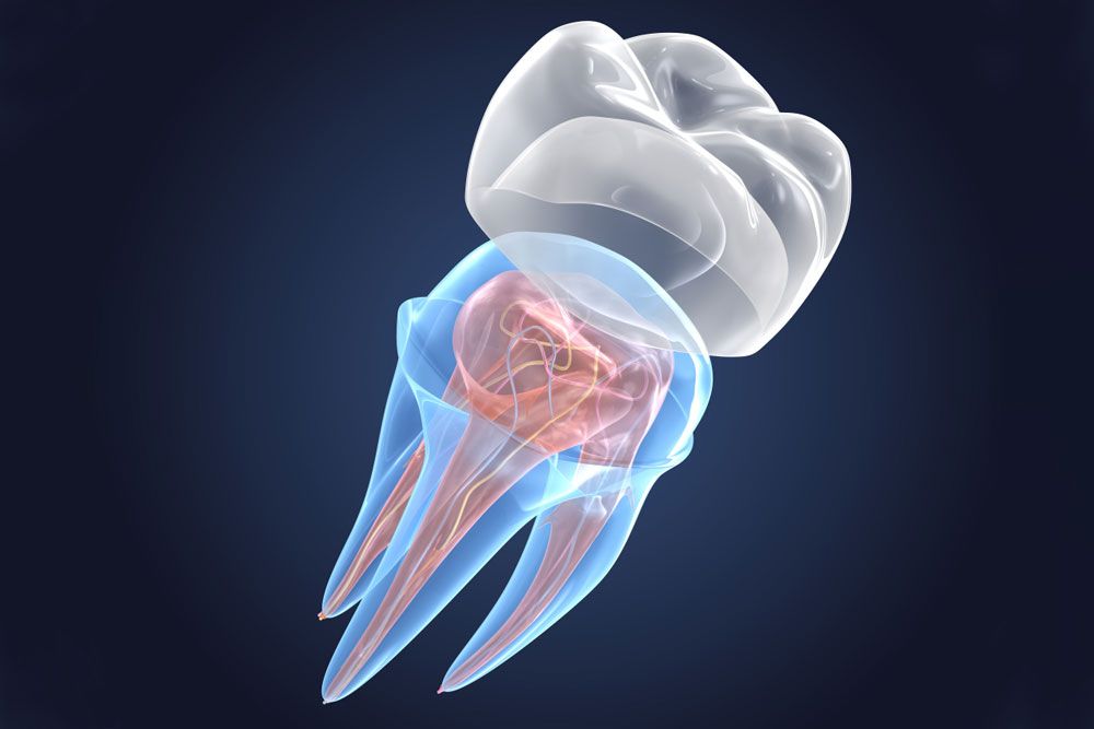 Transparent teeth with crown