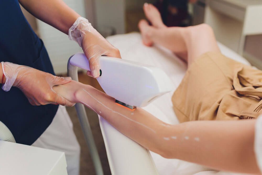 Laser hair removal on ladies legs