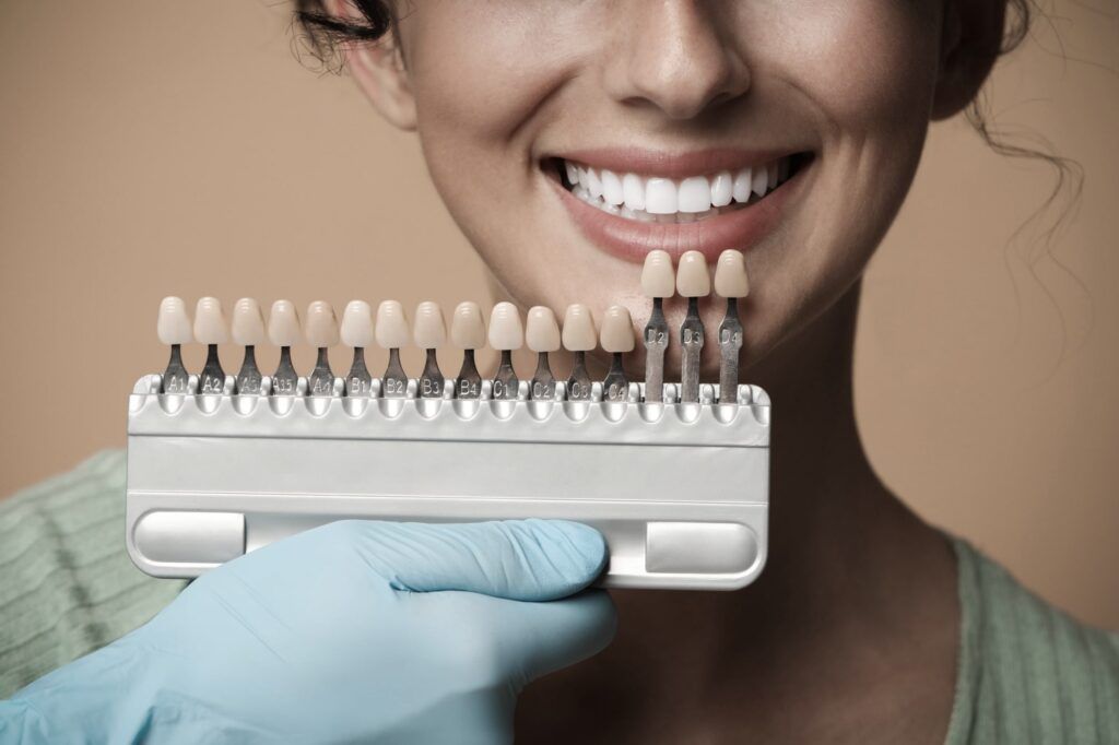 Teeth Whitening