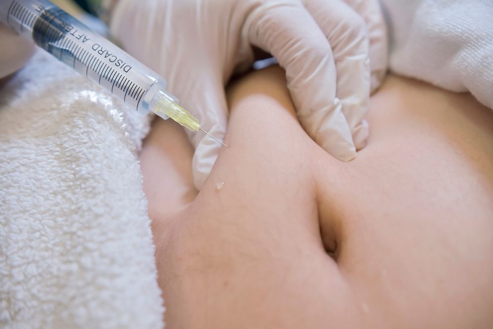 Closeup,Of,A,Lipotropic,Injection,Into,The,Subcutaneous,Fat,Below