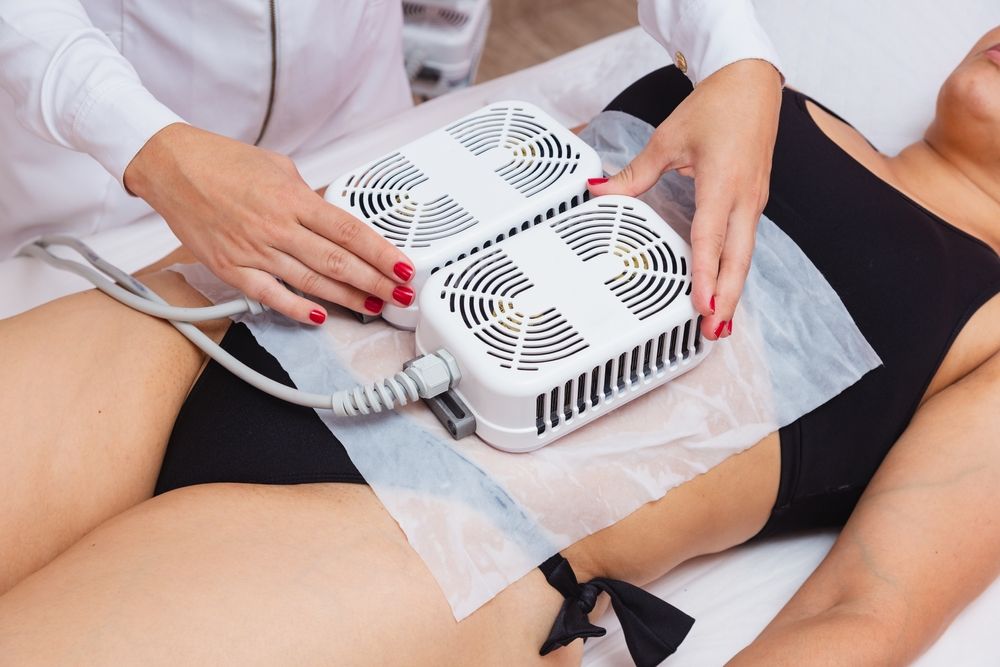 Application,Of,Cryolipolysis,,Cryotherapy,,Preparing,To,Apply,To,The,Patient's