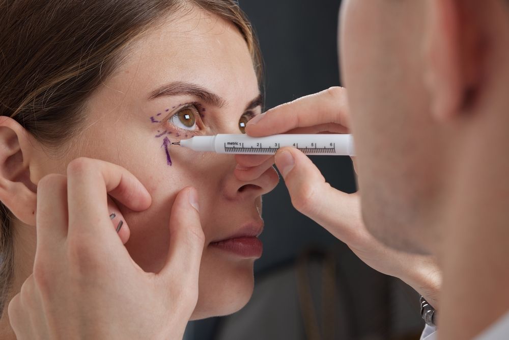 Plastic,Surgeon,Prepares,For,Blepharoplasty,,Blepharoplasty,Operation