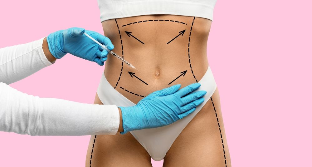 Non-surgical,Body,Lifting,Sculpturing,Concept.,Unrecognizable,Young,Woman,In,Underwear