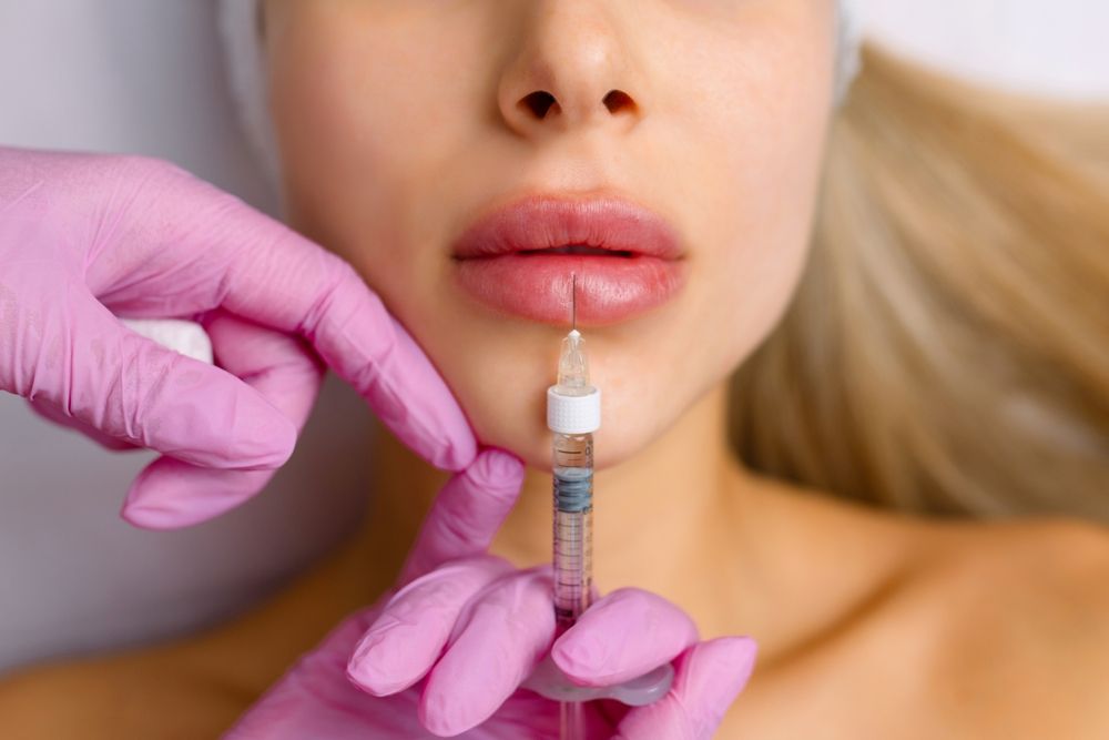 Injection,Procedure,For,Lip,Augmentation,,Close-up.,The,Cosmetologist,Slowly,And