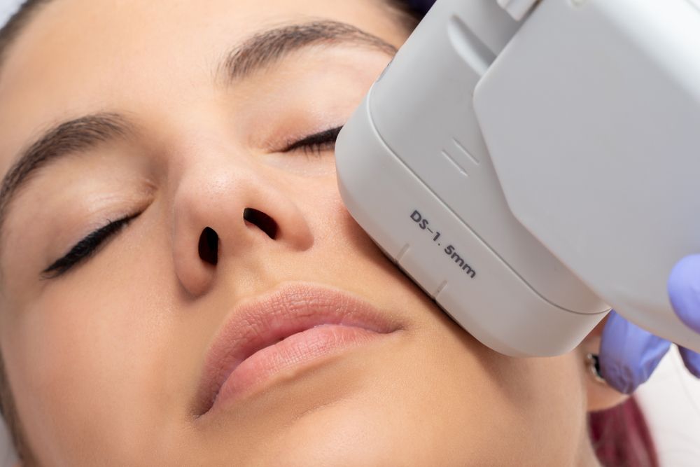 Woman,Receiving,High,Intensity,Focused,Ultrasound,Treatment,On,Face.,Therapist