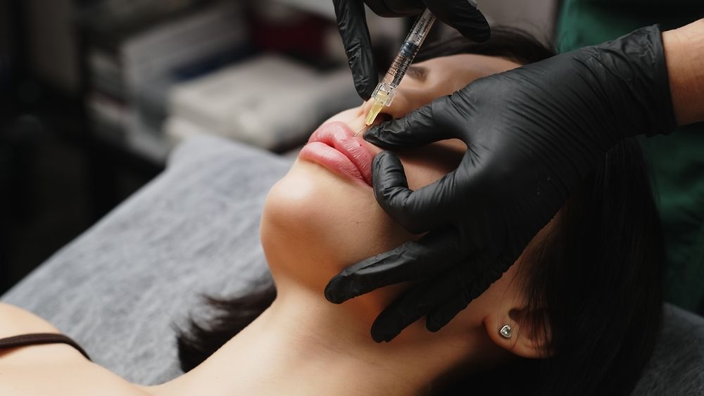 Injection,Procedure,For,Lip,Augmentation,,Close-up.,